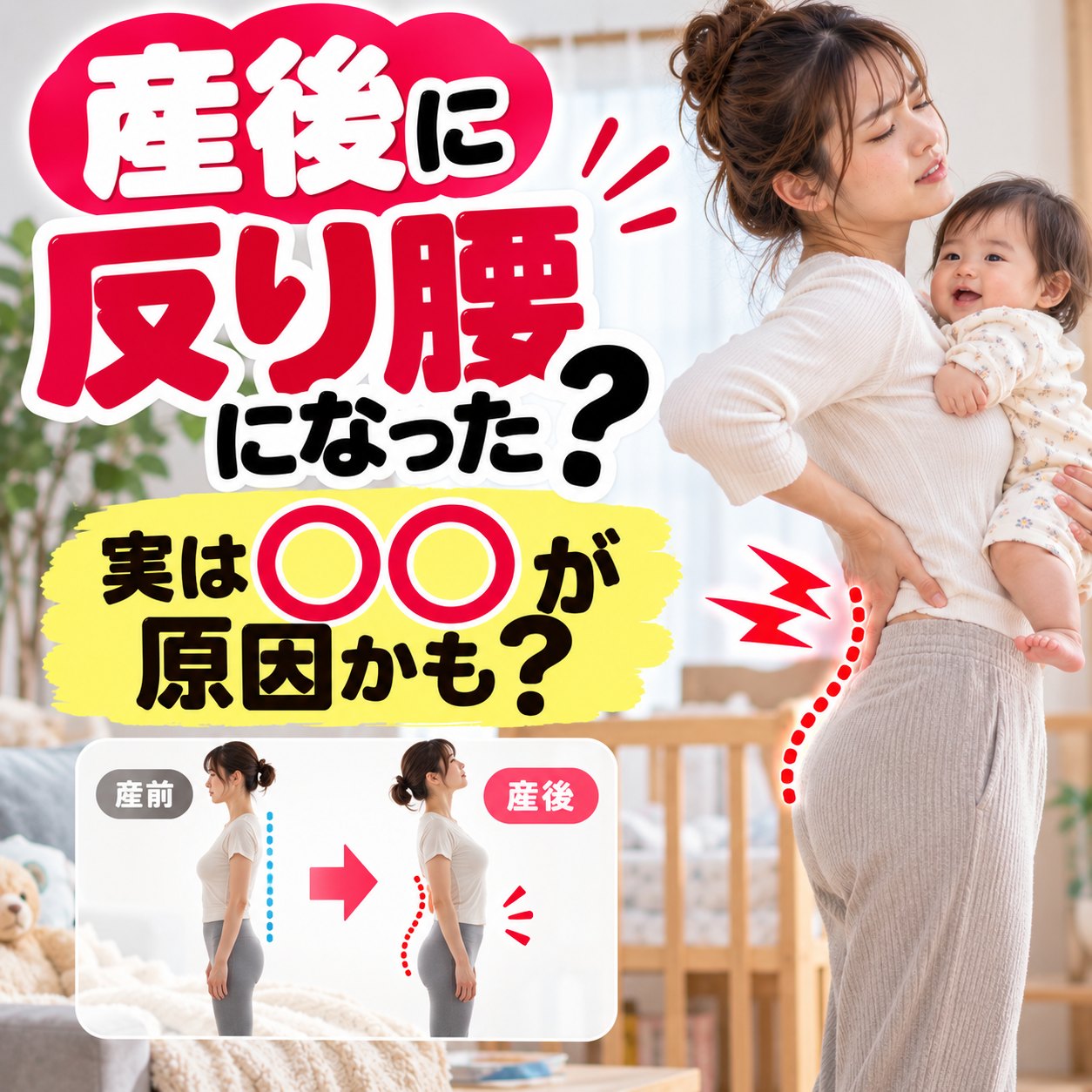 産後に反り腰になり、お腹が前に出て腰が反った姿勢のママ｜ひなた整骨院
